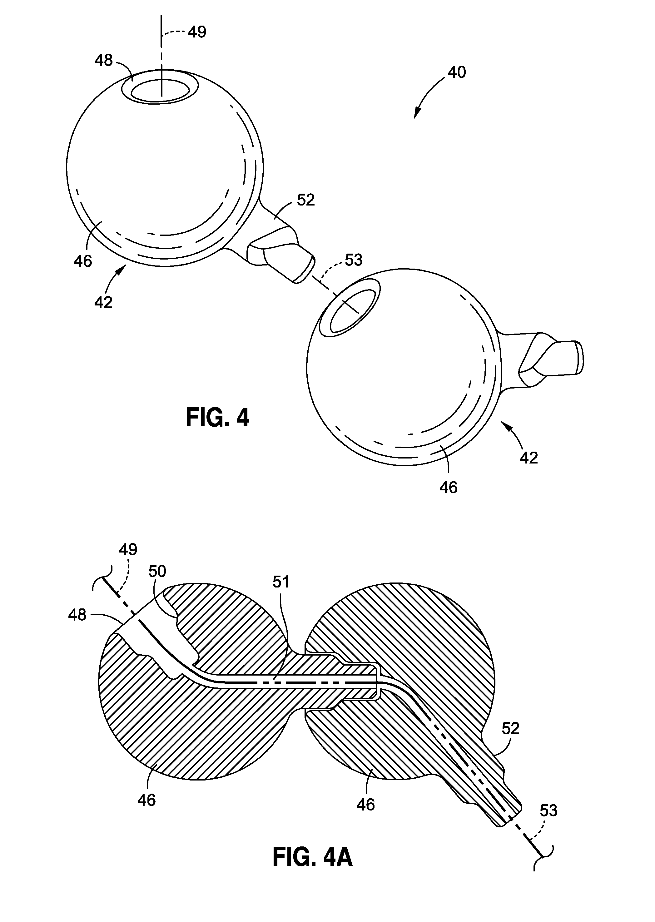 Non-inflatable gastric implants and systems