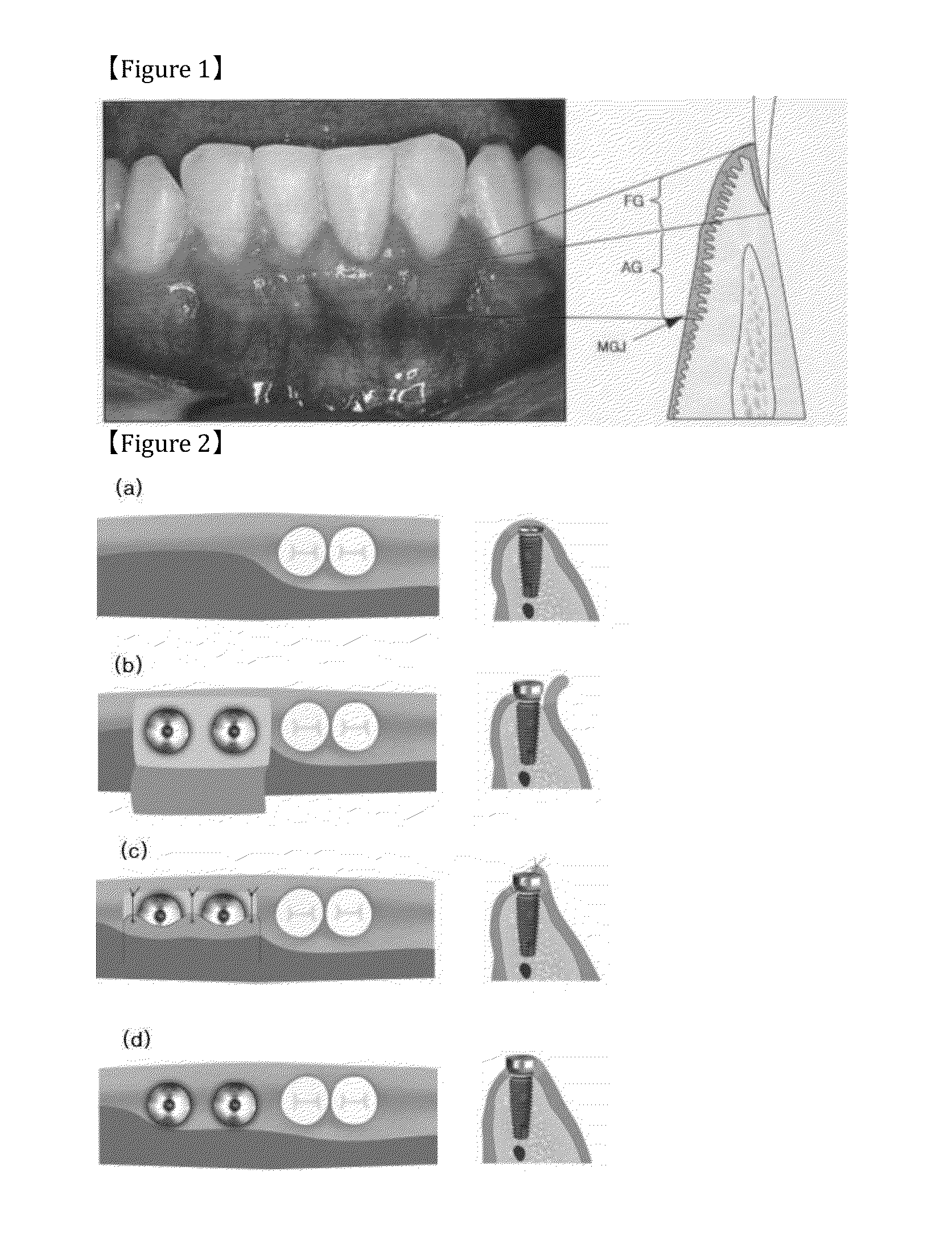 Button for implnat healing abutment and implant healing abutment having pressing part