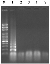 Lamp detection kit and detection method of macrobrachium rosenbergii dicistronic virus