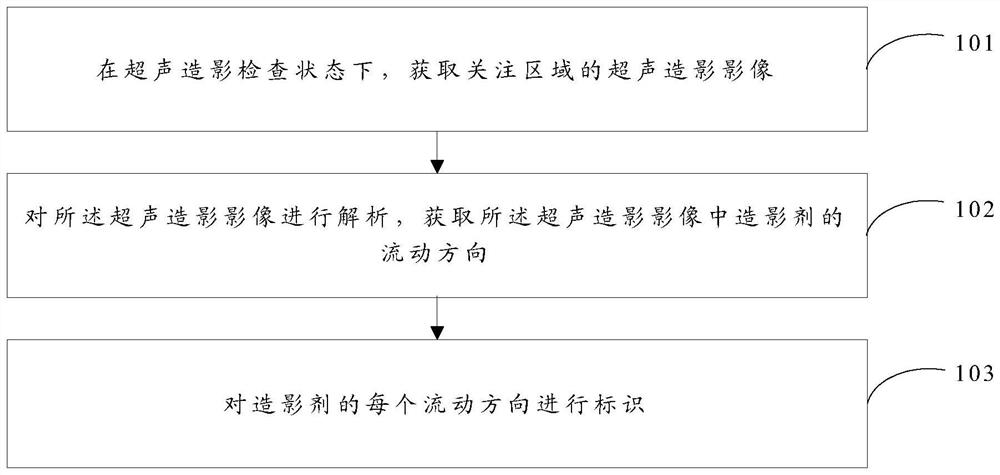 Method, device and equipment for marking flow direction of contrast medium