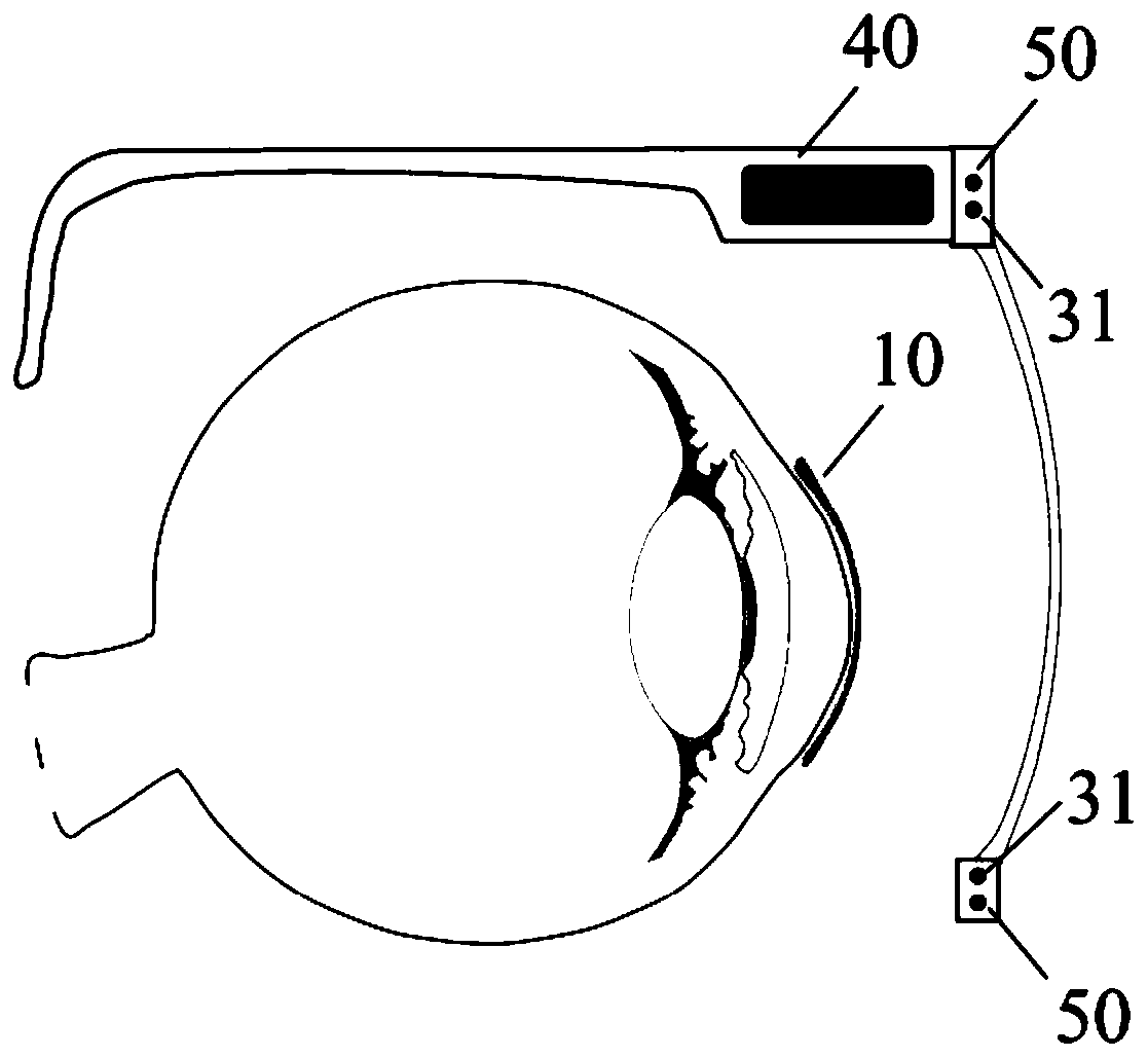Intraocular-pressure continuous glaucoma detection system and detection method thereof