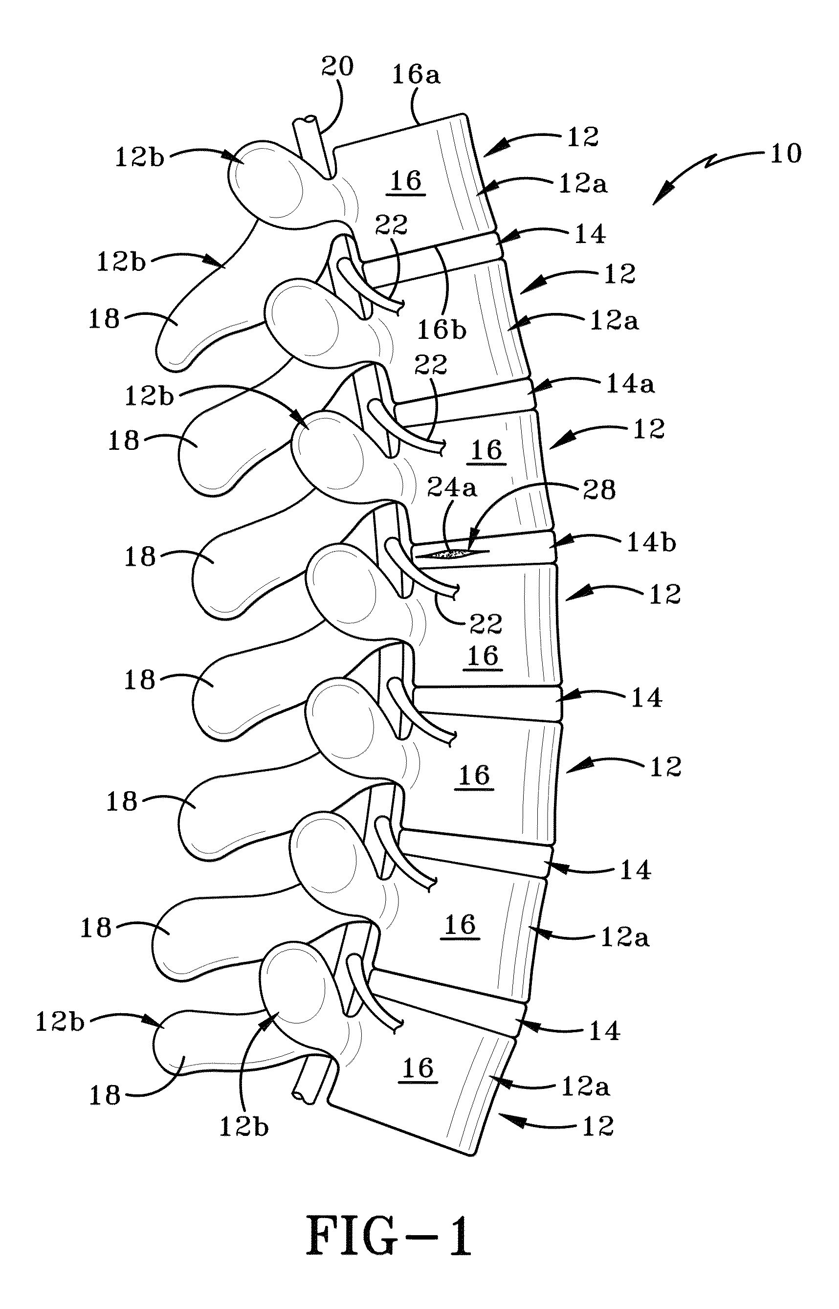 Nucleus pulposus spinal implant and method of using the same