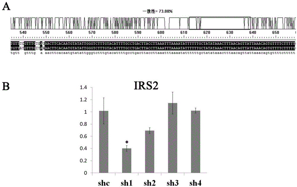 A kind of shrna that suppresses irs2 gene expression and application