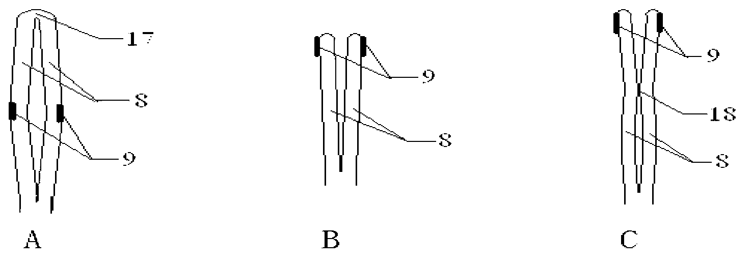 Radio frequency ablation (RFA) catheter system for denervation of renal sympathetic nerves