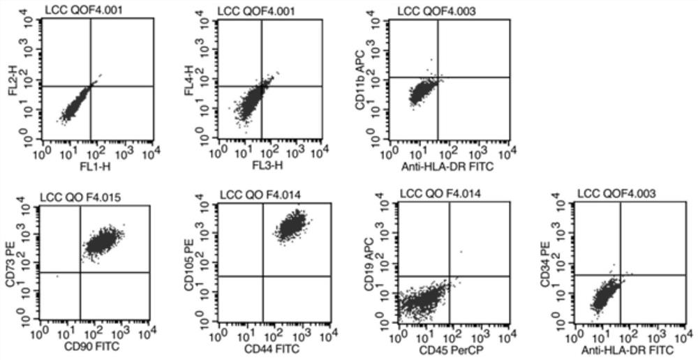 Umbilical cord tissue cryopreservation liquid and preparation method thereof, and cryopreservation method and culture method of umbilical cord tissue