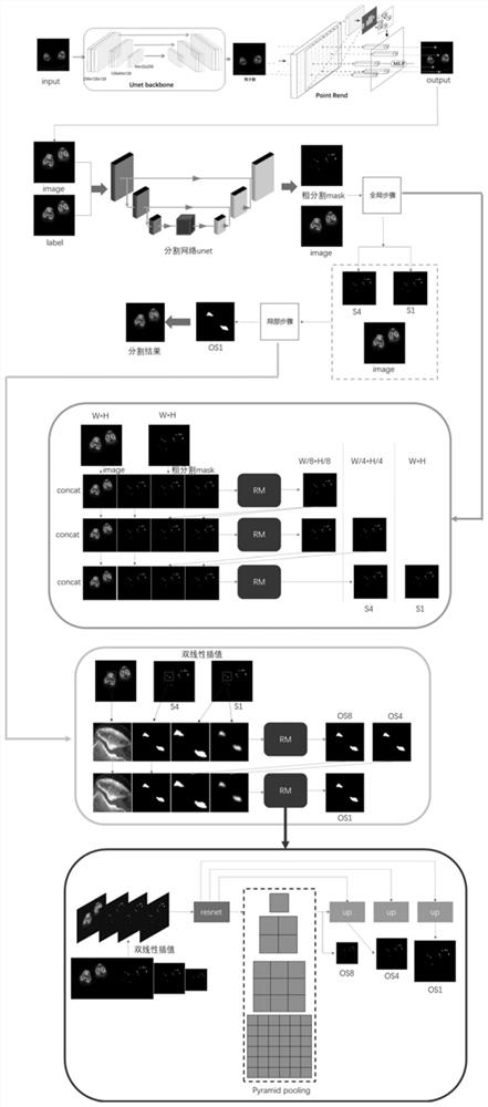 Osteophyte identification method, device, electronic equipment and storage medium