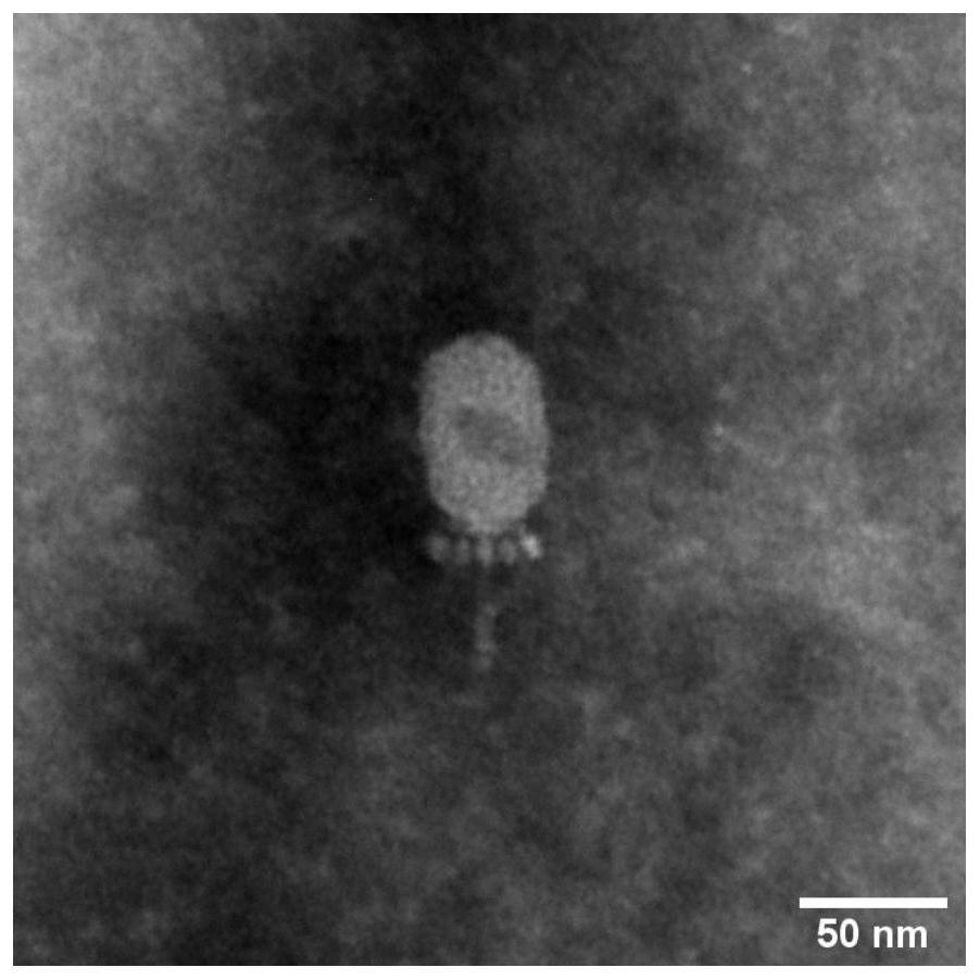 Bacillus cereus phage DLn1 and application thereof