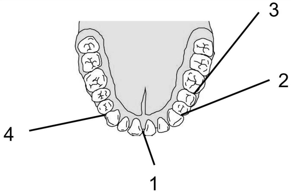 Mandible operation spatial modeling method for intraoral incison