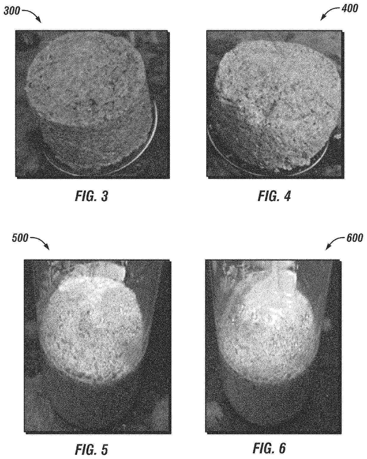 Acid-soluble plug forming rapidly dehydrating loss control slurry