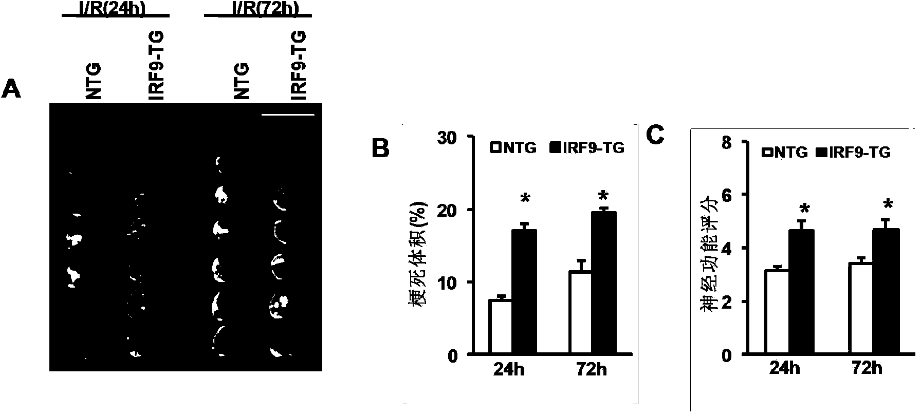 Interferon regulatory factor 9 (IRF9) and application of inhibitor thereof in cerebral apoplexy