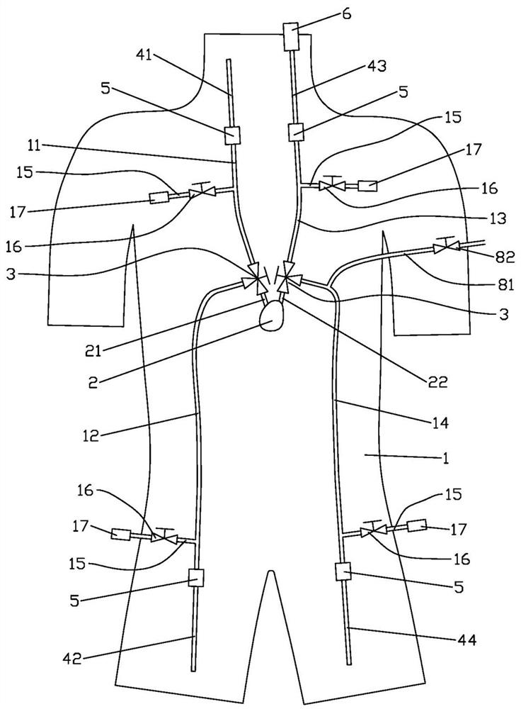 An ecmo simulation training human body model for easy exhaust