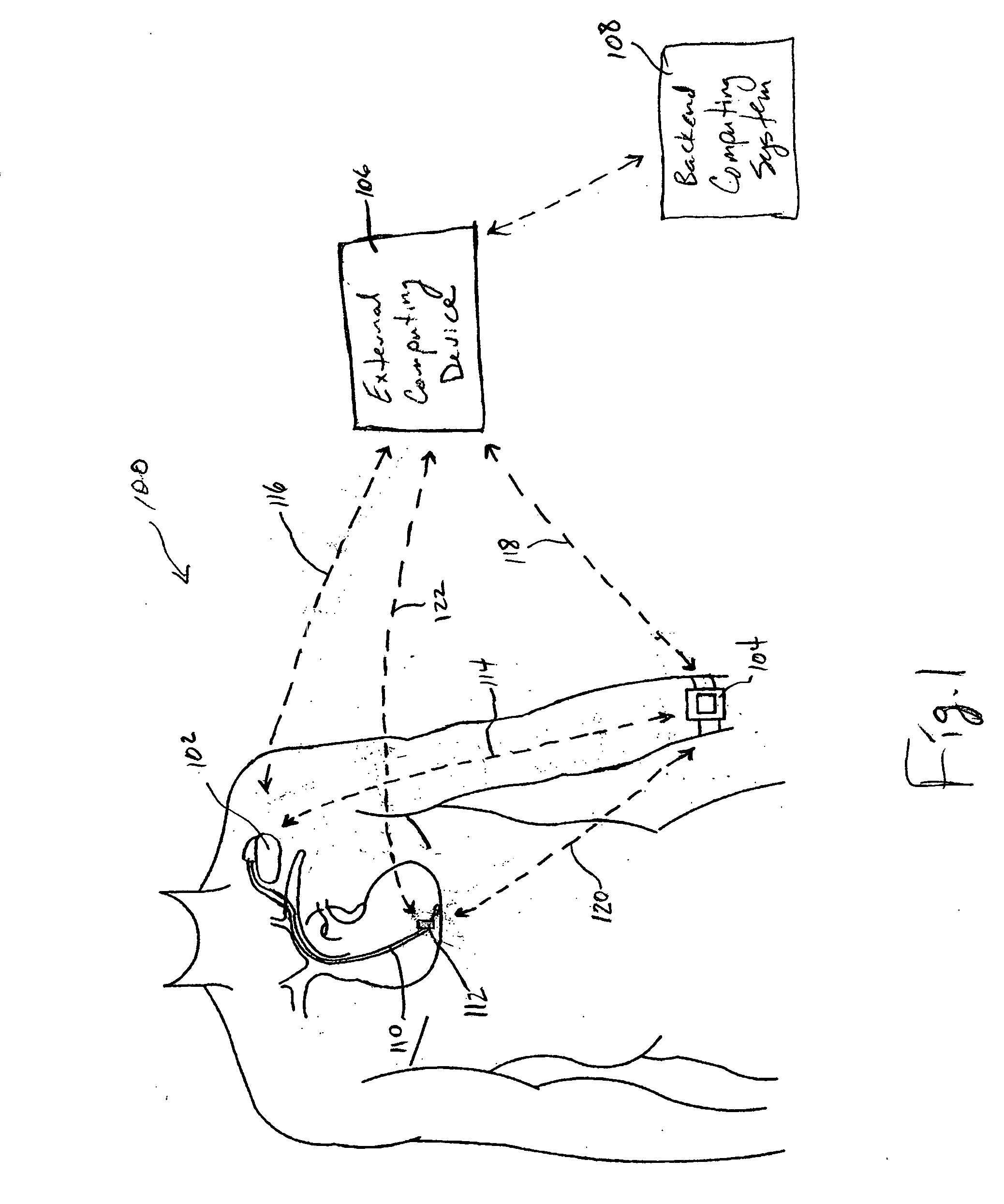 Systems and methods for deriving relative physiologic measurements using an implanted sensor device