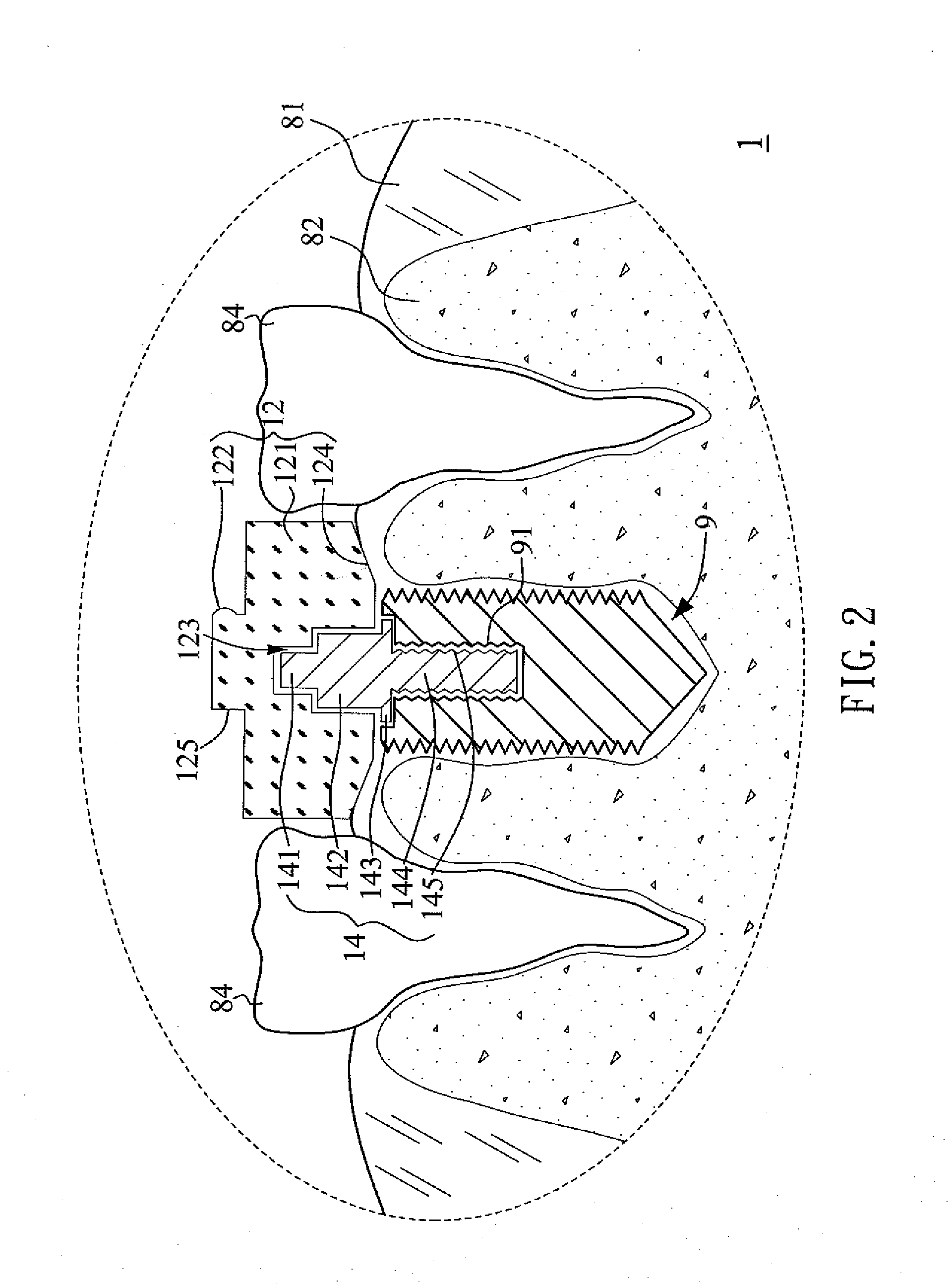 Multi Functional Implanting Suite and Implanting Method Thereof