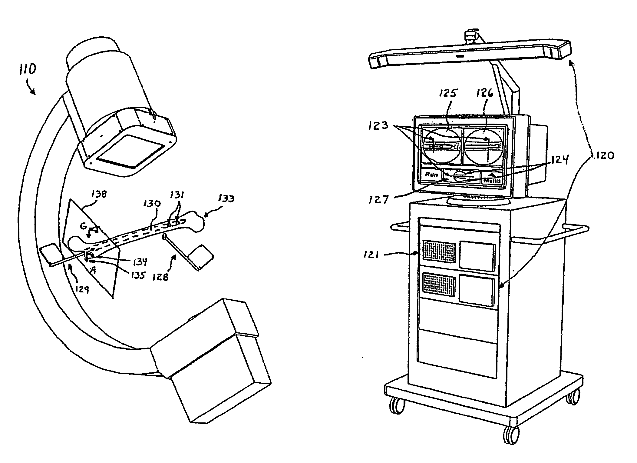 Computer assisted intramedullary rod surgery system with enhanced features