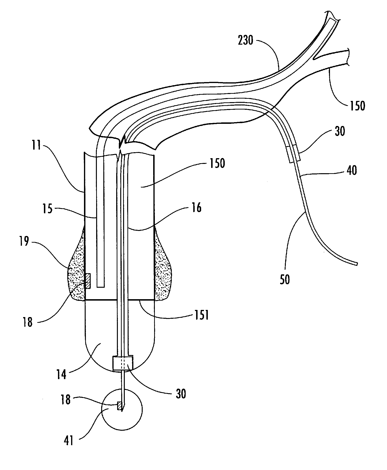 Fluid flowing device and method for tissue diagnosis or therapy