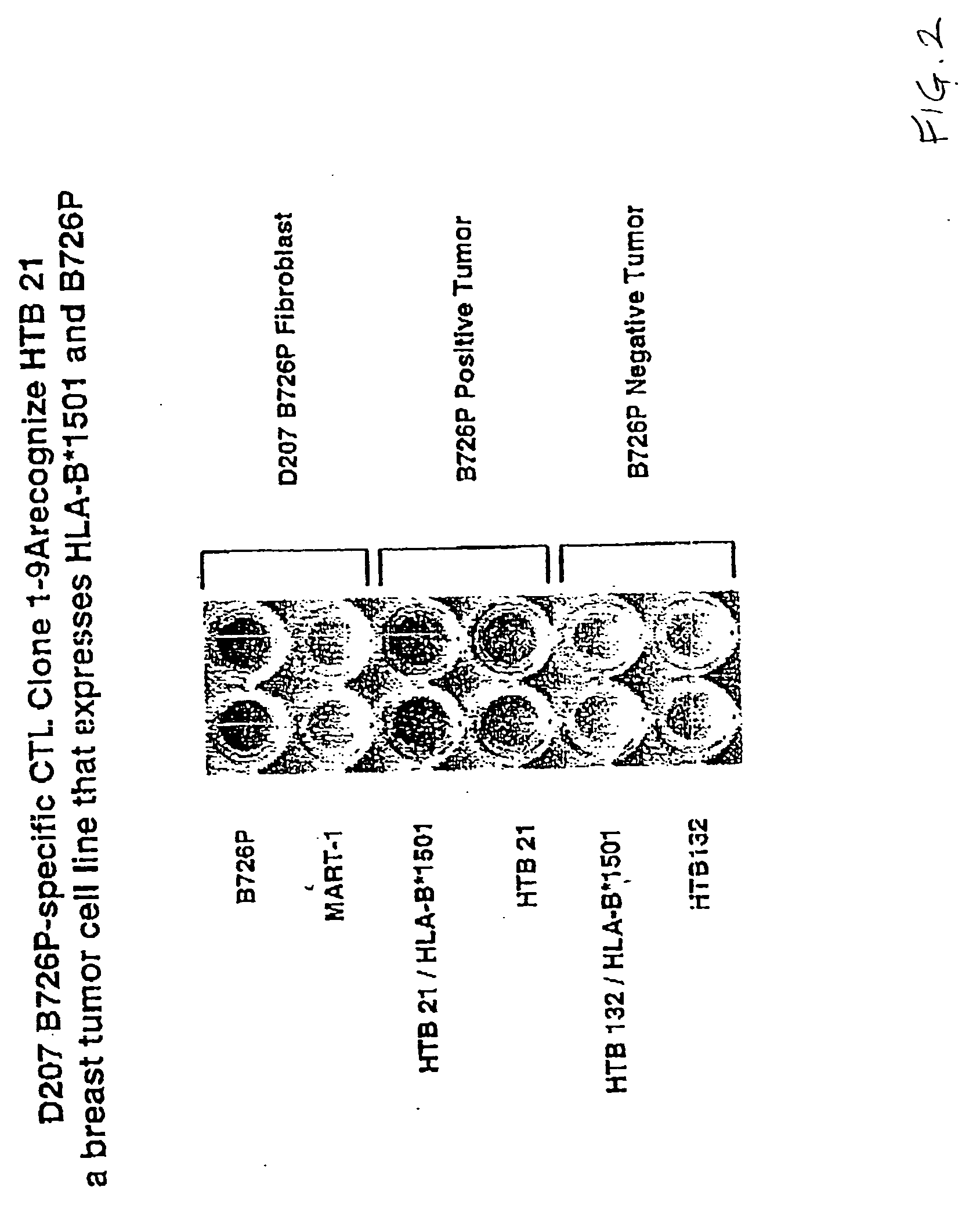 Compositions and methods for the therapy and diagnosis of breast cancer