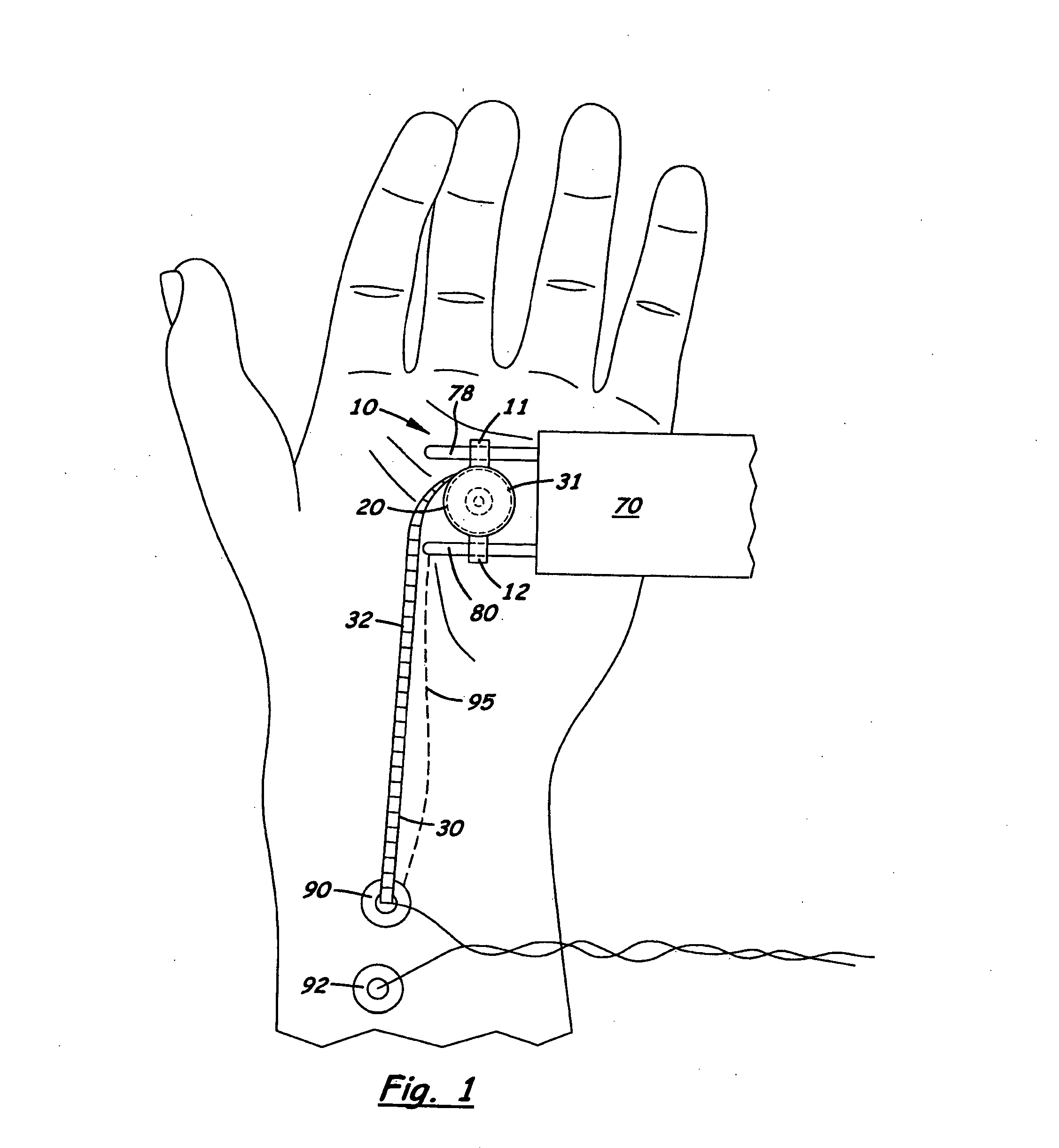 Nerve stimulator measuring device