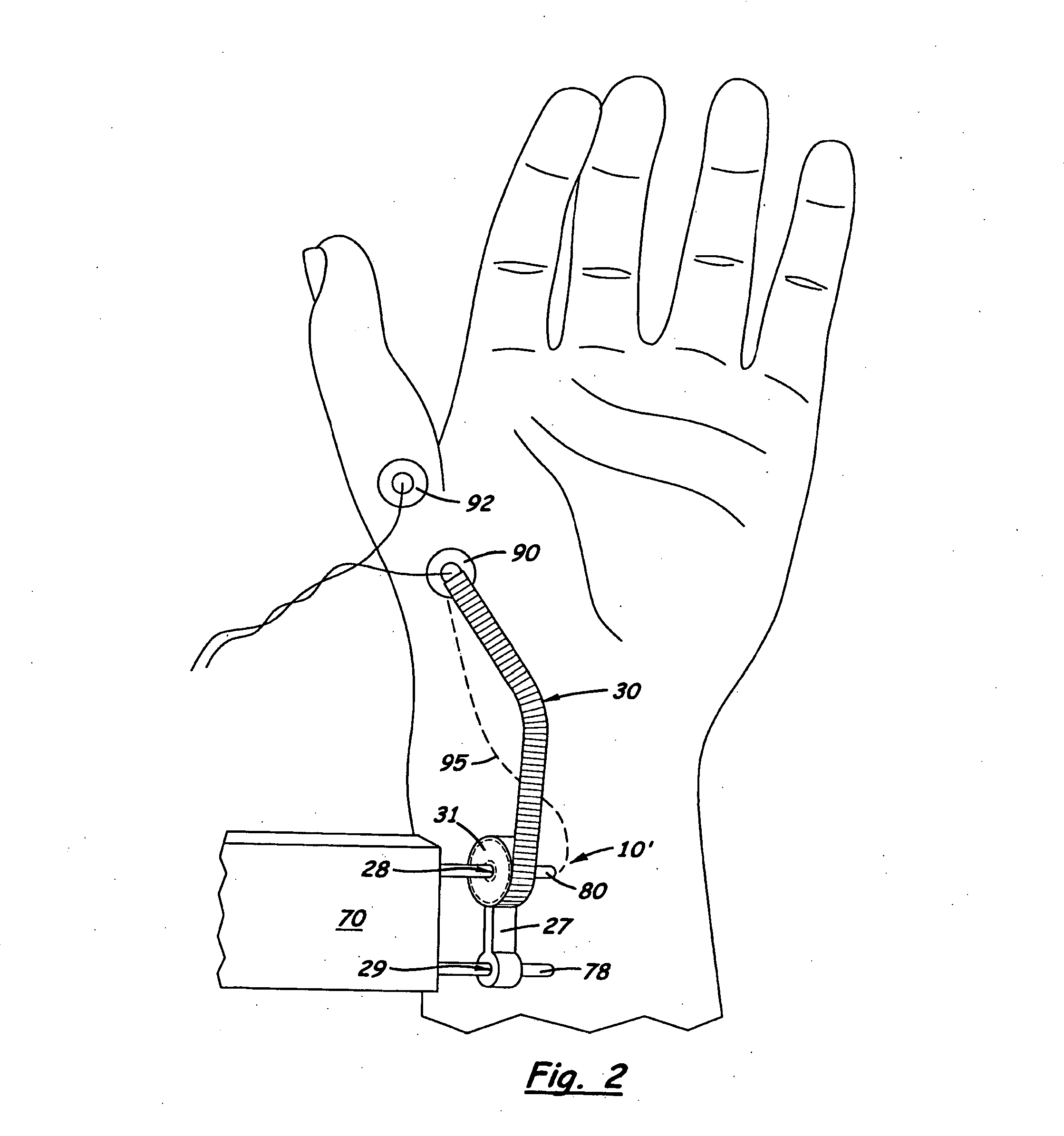 Nerve stimulator measuring device