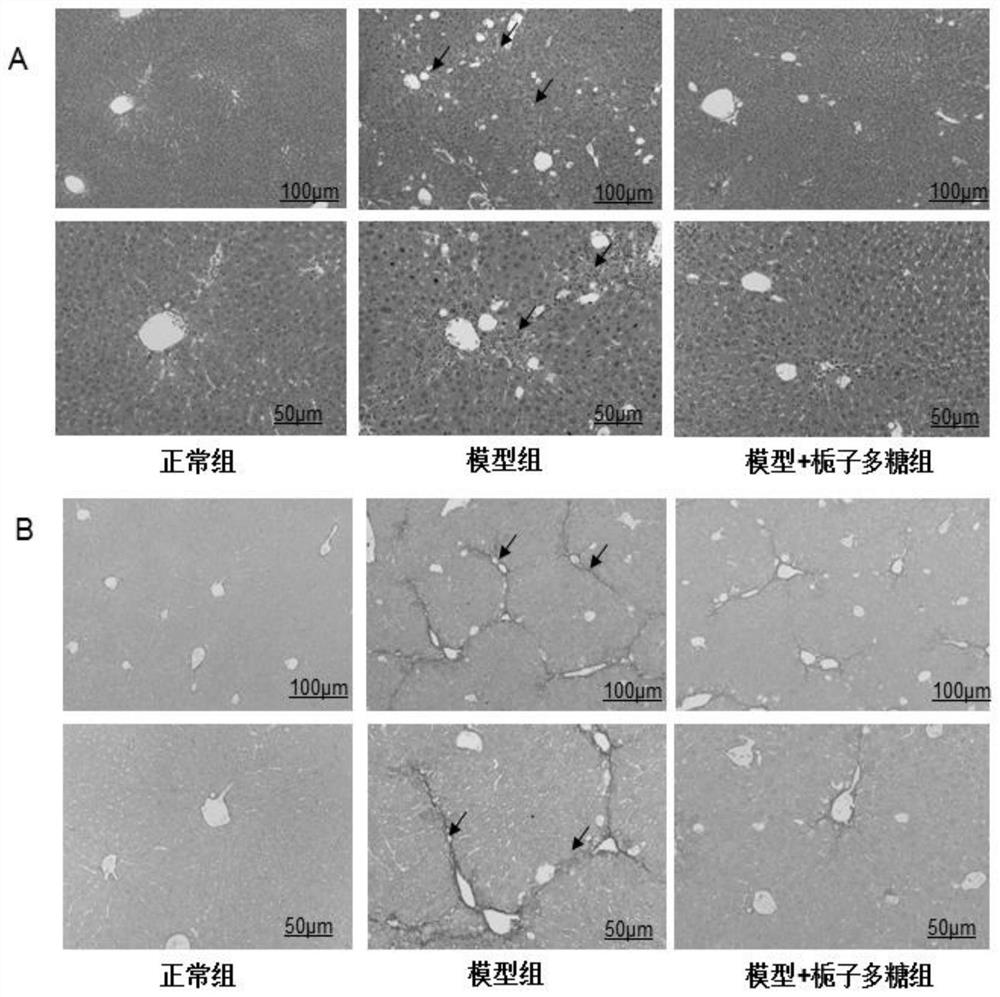 A kind of gardenia polysaccharide and its preparation method and application