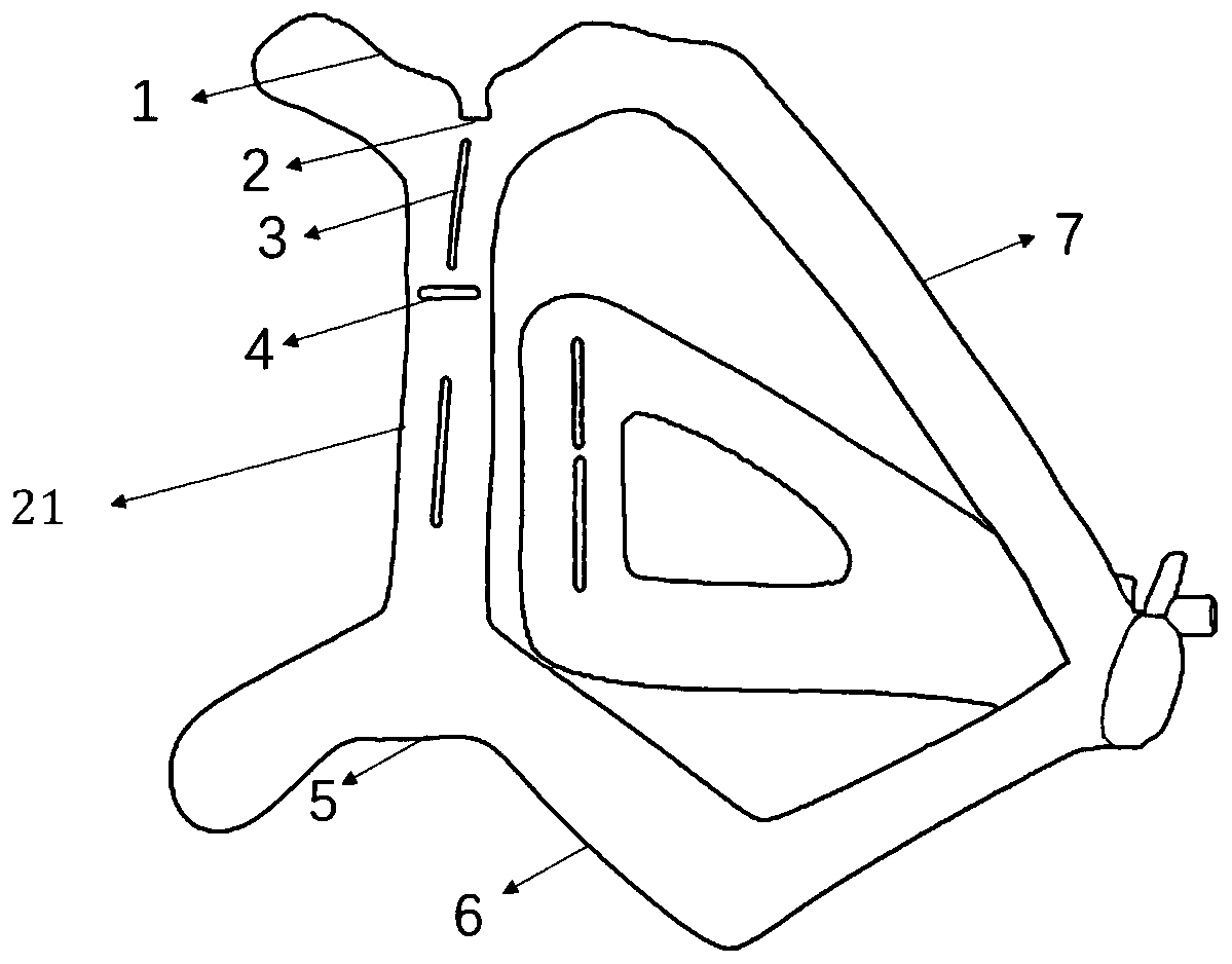 3D printing guide plate device for assisting percutaneous lung puncture based on body surface mark