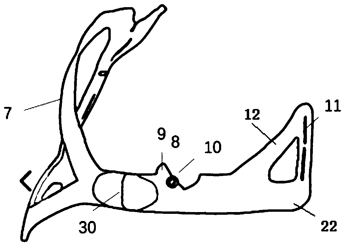 3D printing guide plate device for assisting percutaneous lung puncture based on body surface mark