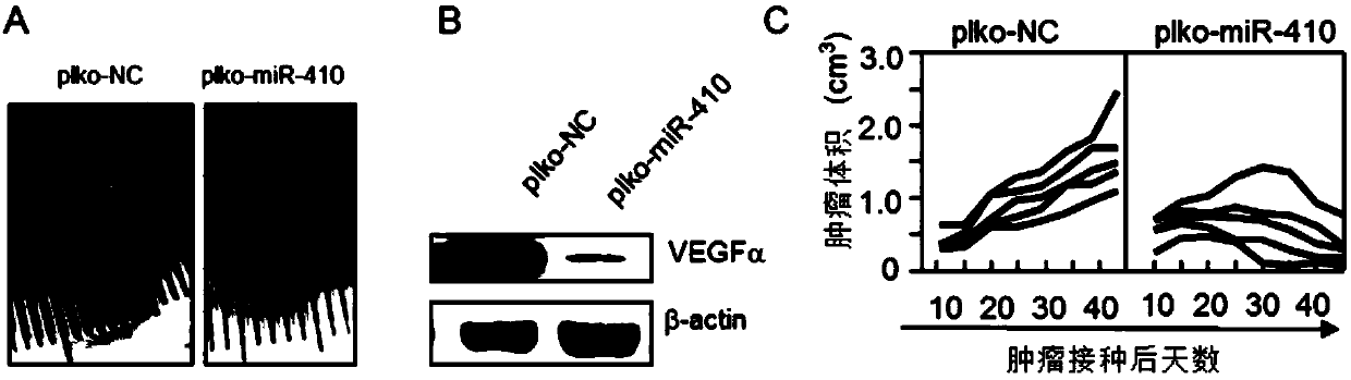 Nucleic acid-derived agiogenesis inhibitor as well as preparation method and application thereof