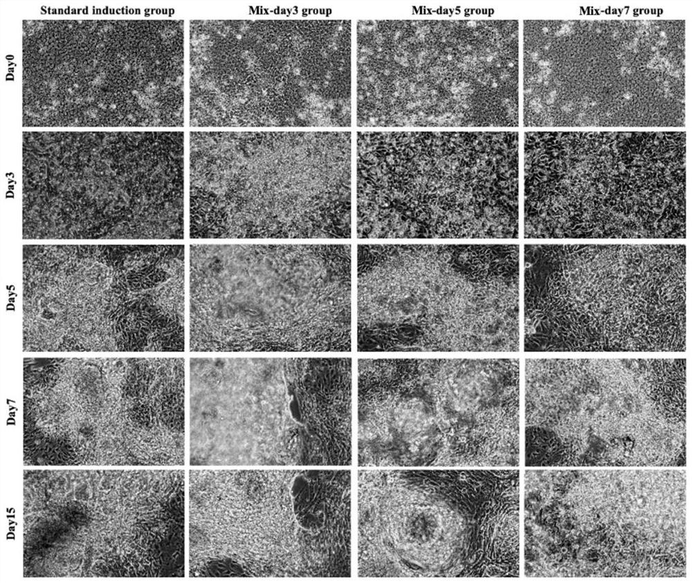 Traditional Chinese medicine composition capable of promoting directed differentiation of stem cells into cardiomyocytes, traditional Chinese medicine effective component composition and application thereof