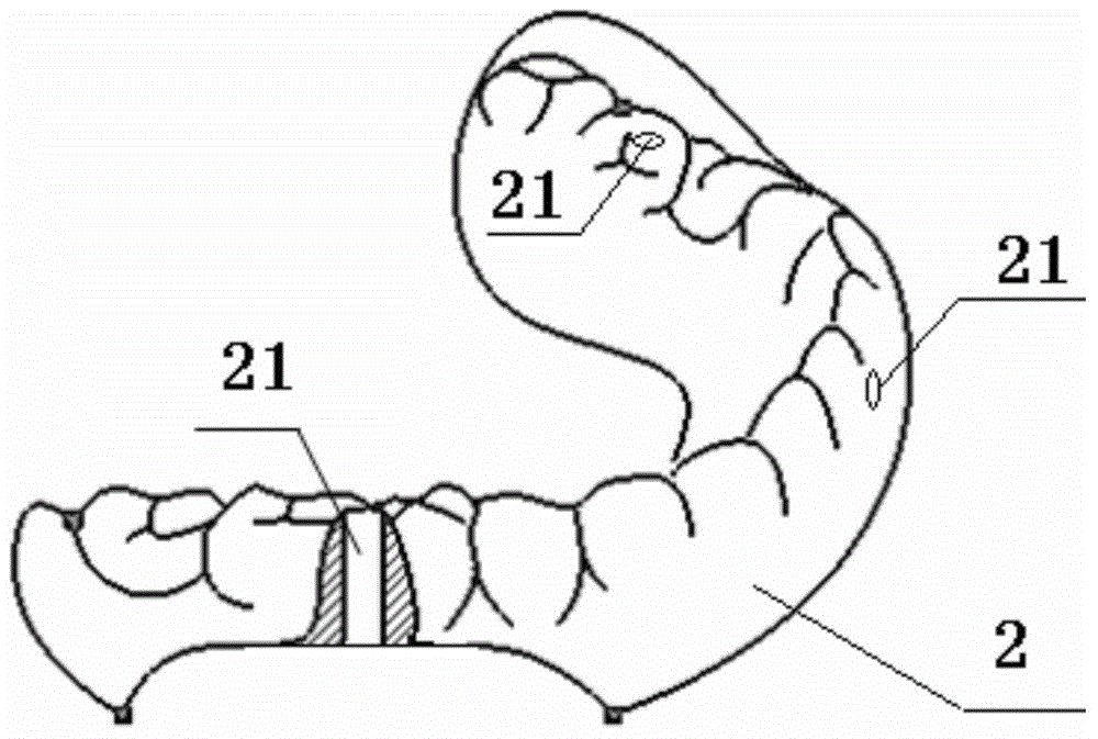 Whole-tooth lost dental implantation operation guide plate and making method thereof
