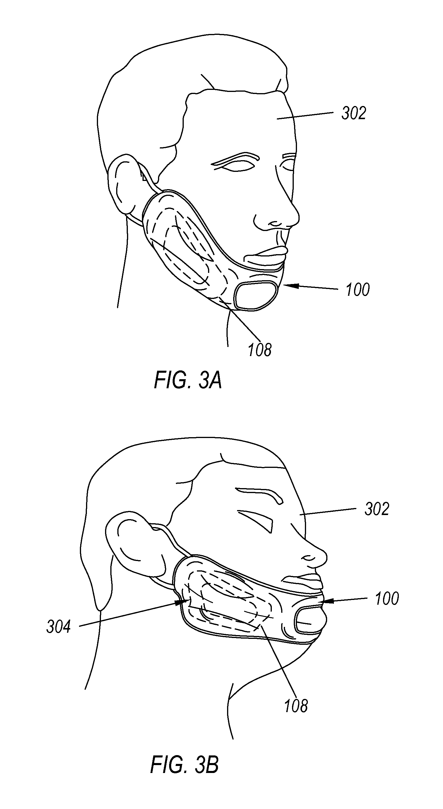 Oral surgery recovery mask