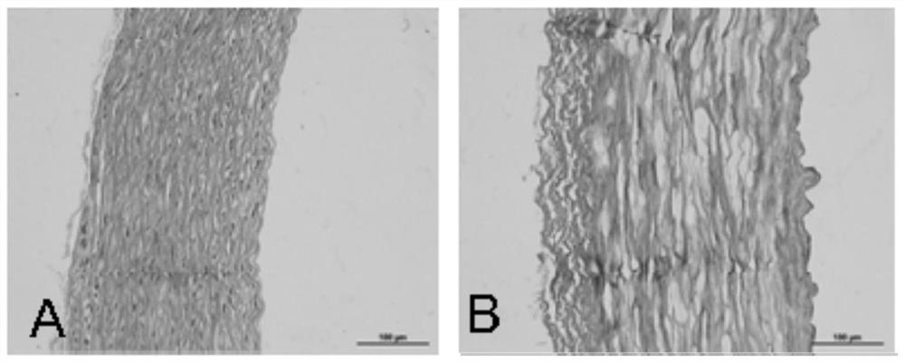 Decellularized vascular matrix and preparation method thereof