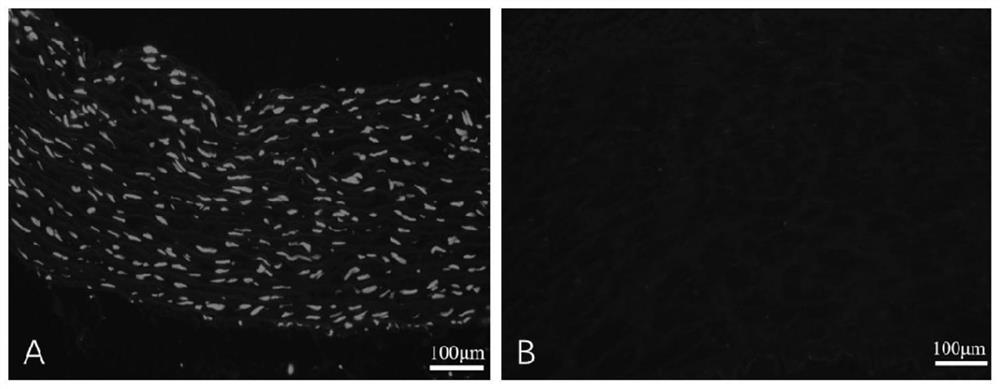 Decellularized vascular matrix and preparation method thereof