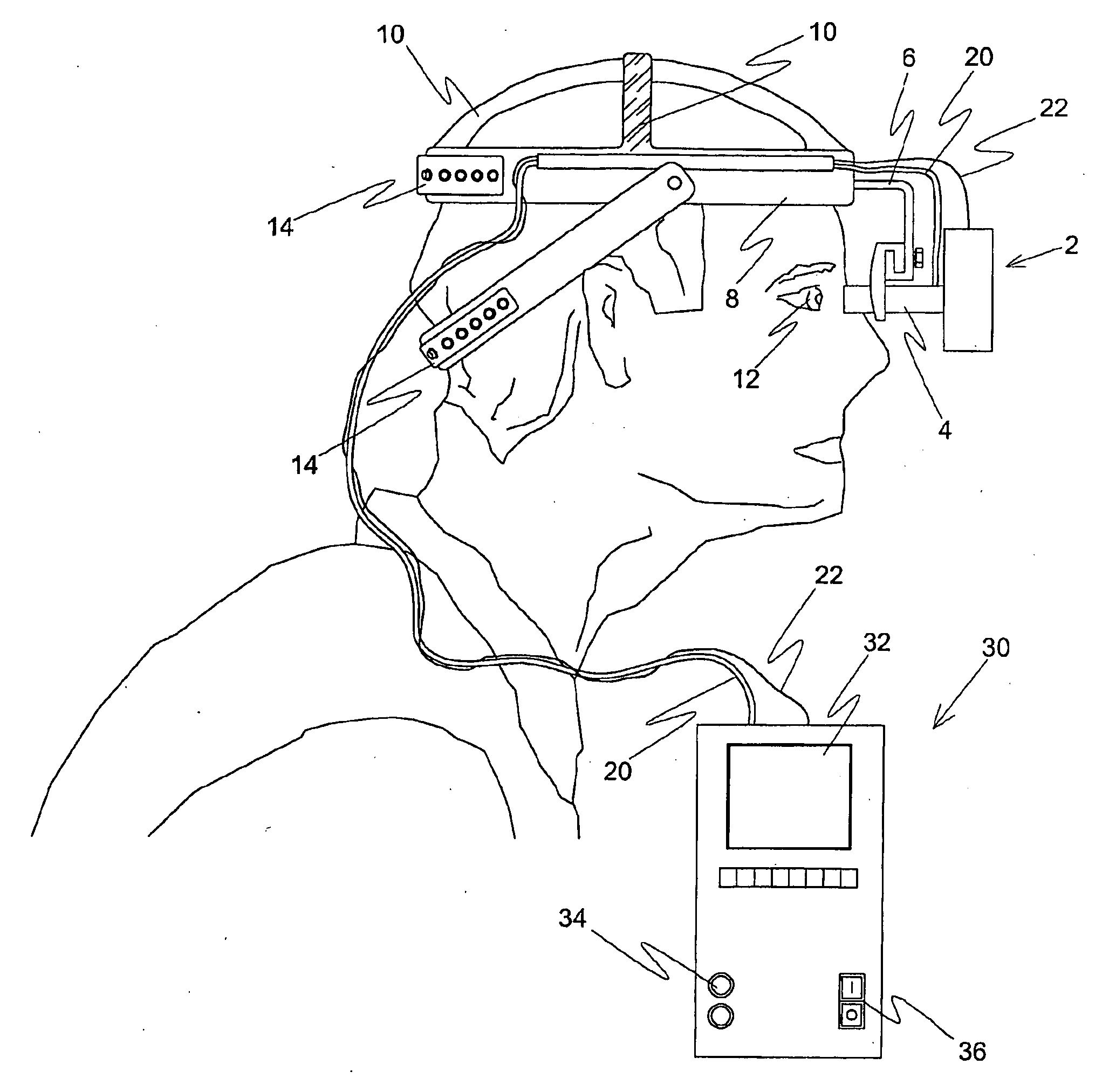 Tonometer