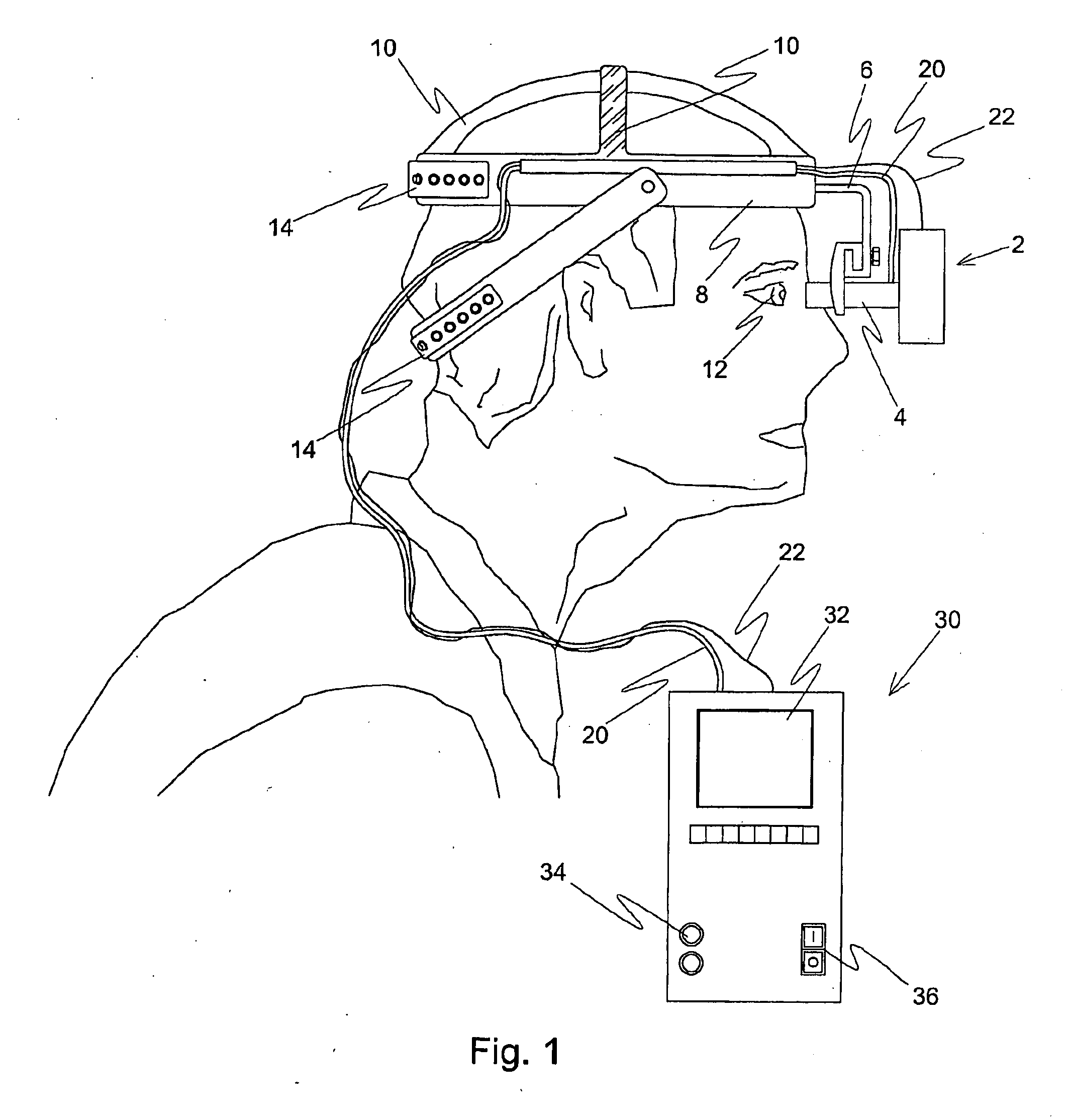 Tonometer