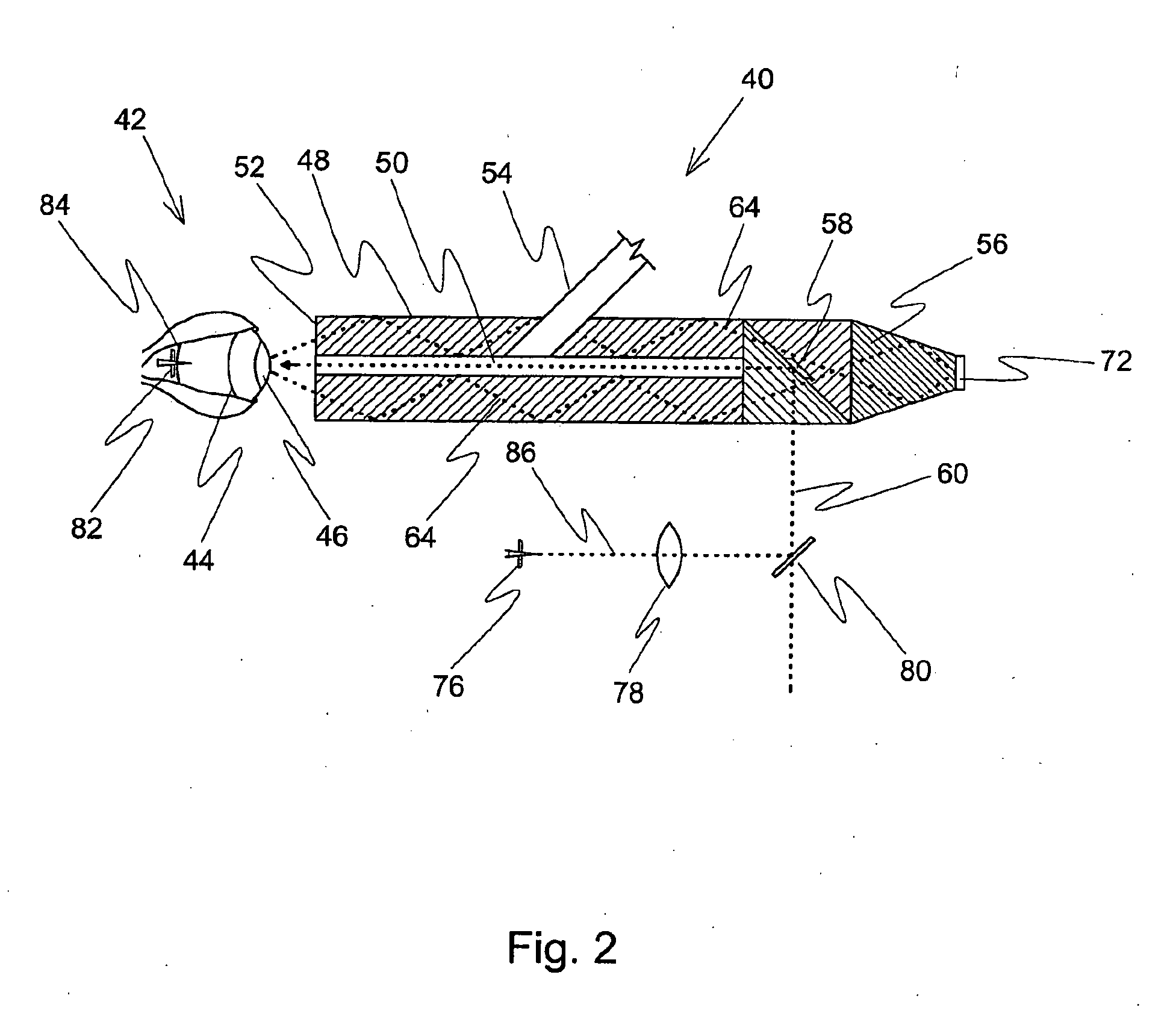 Tonometer