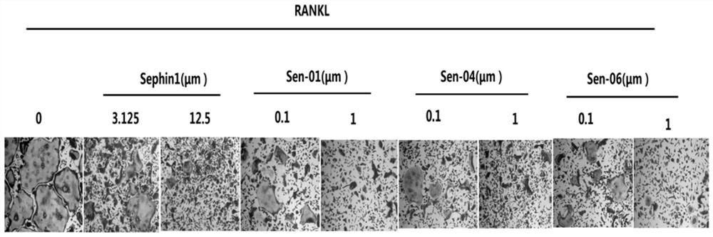 Substituted guanidyl-containing derivative and application thereof in preparation of osteoclast differentiation inhibitor