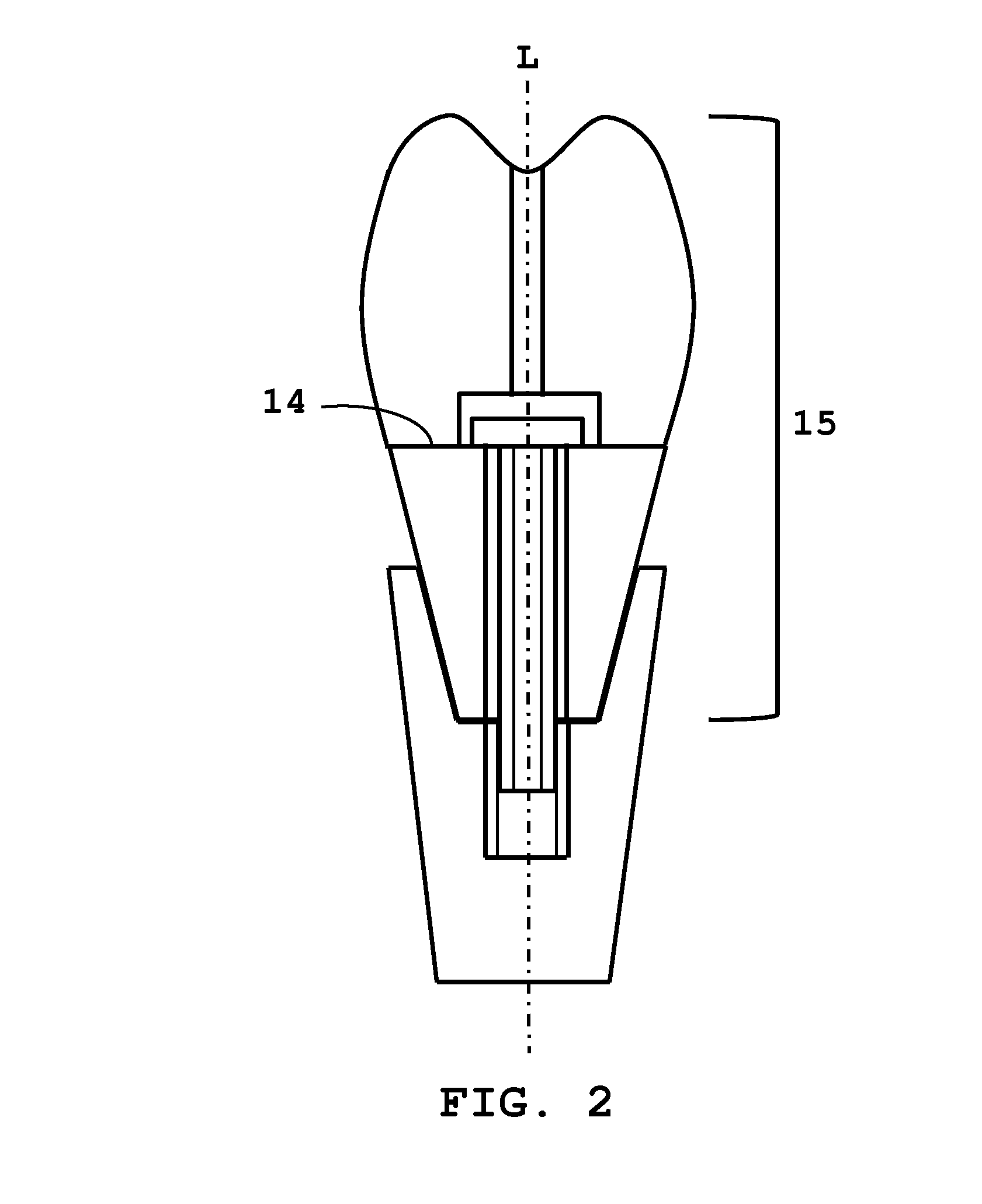 Dental kit-of-parts and method of assembling the same