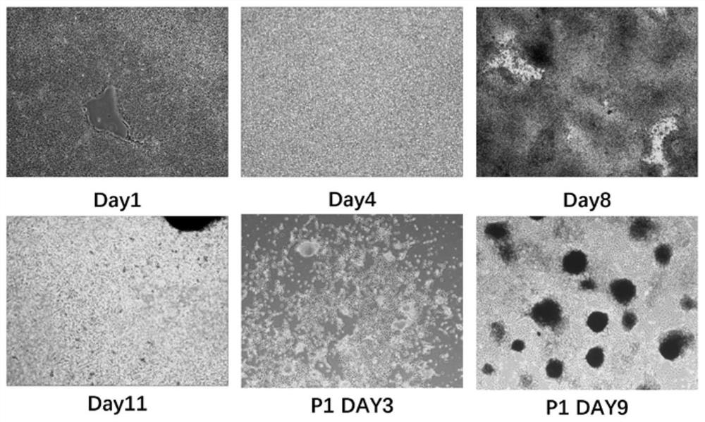 Method for inducing pluripotent stem cells to differentiate into melanocytes in serum-free culture solution
