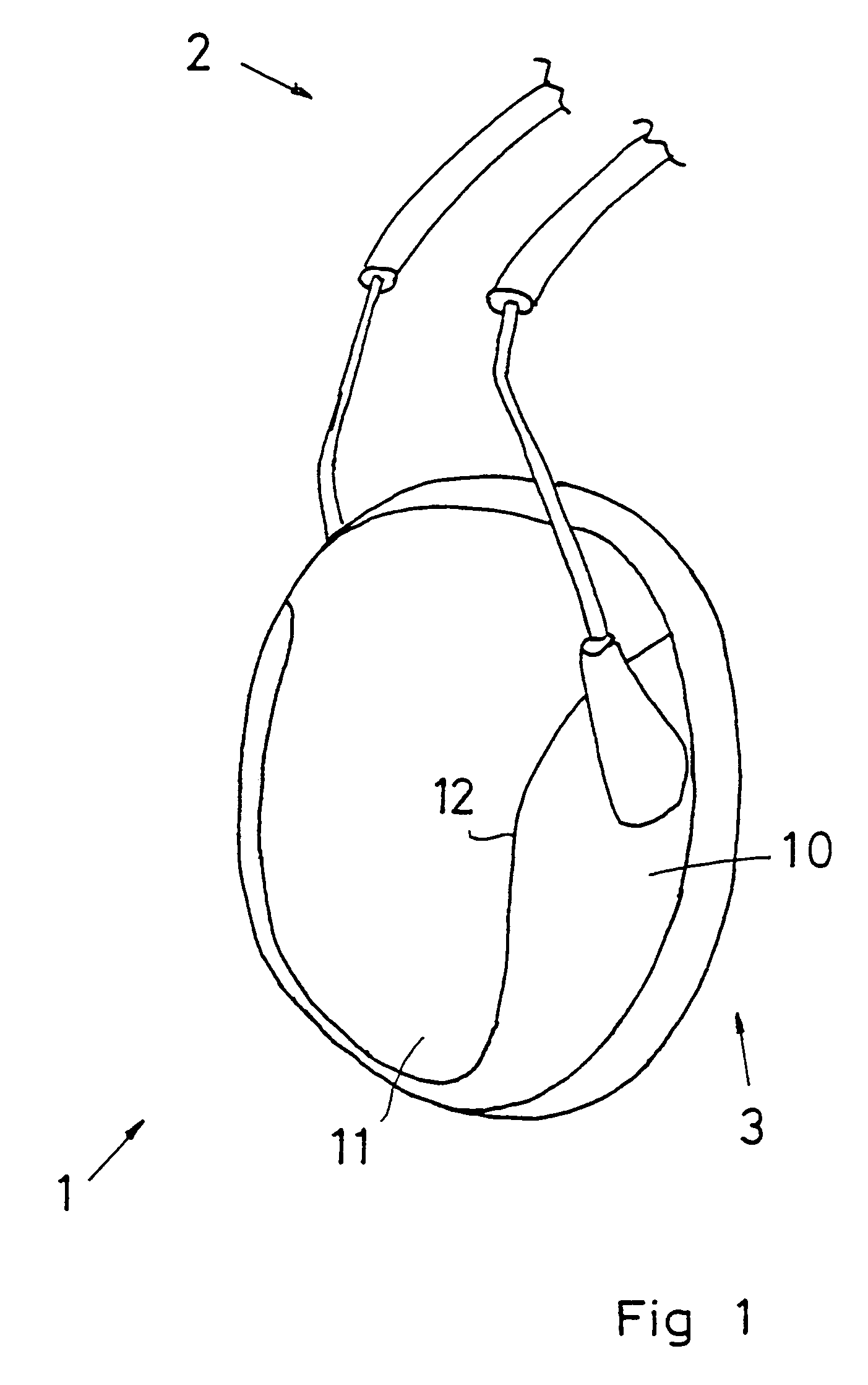 Method of producing a hood, and a hood produced according to the method