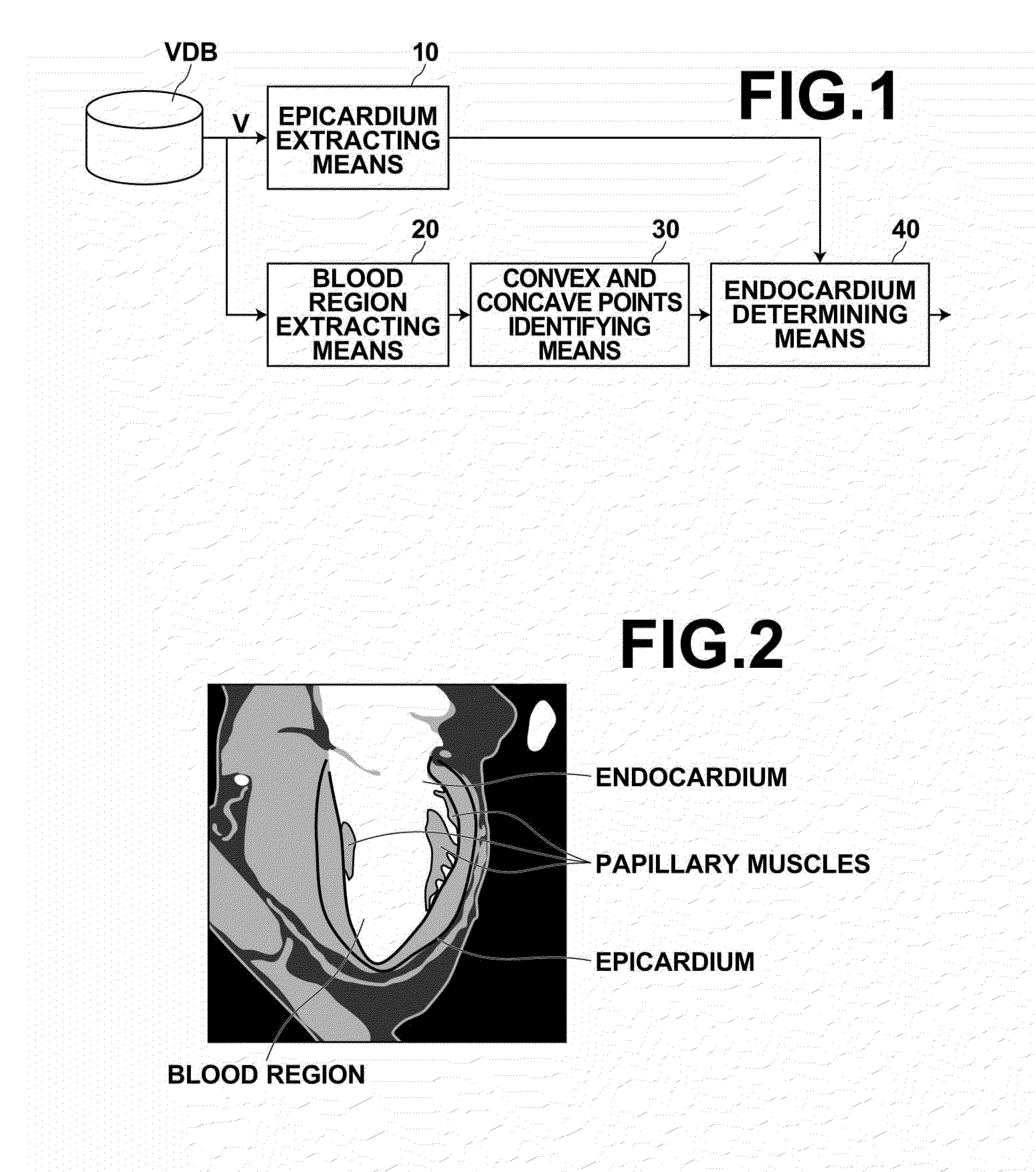 Medical image processing device, method and program