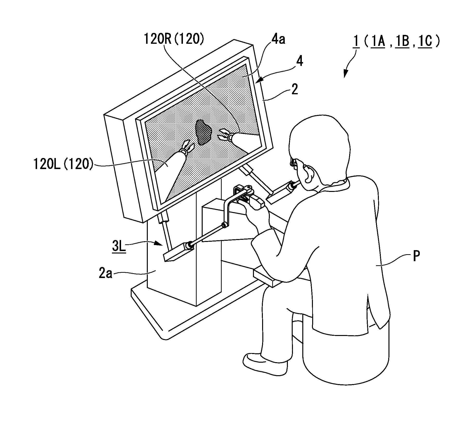 Operation input device and method of initializing operation input device