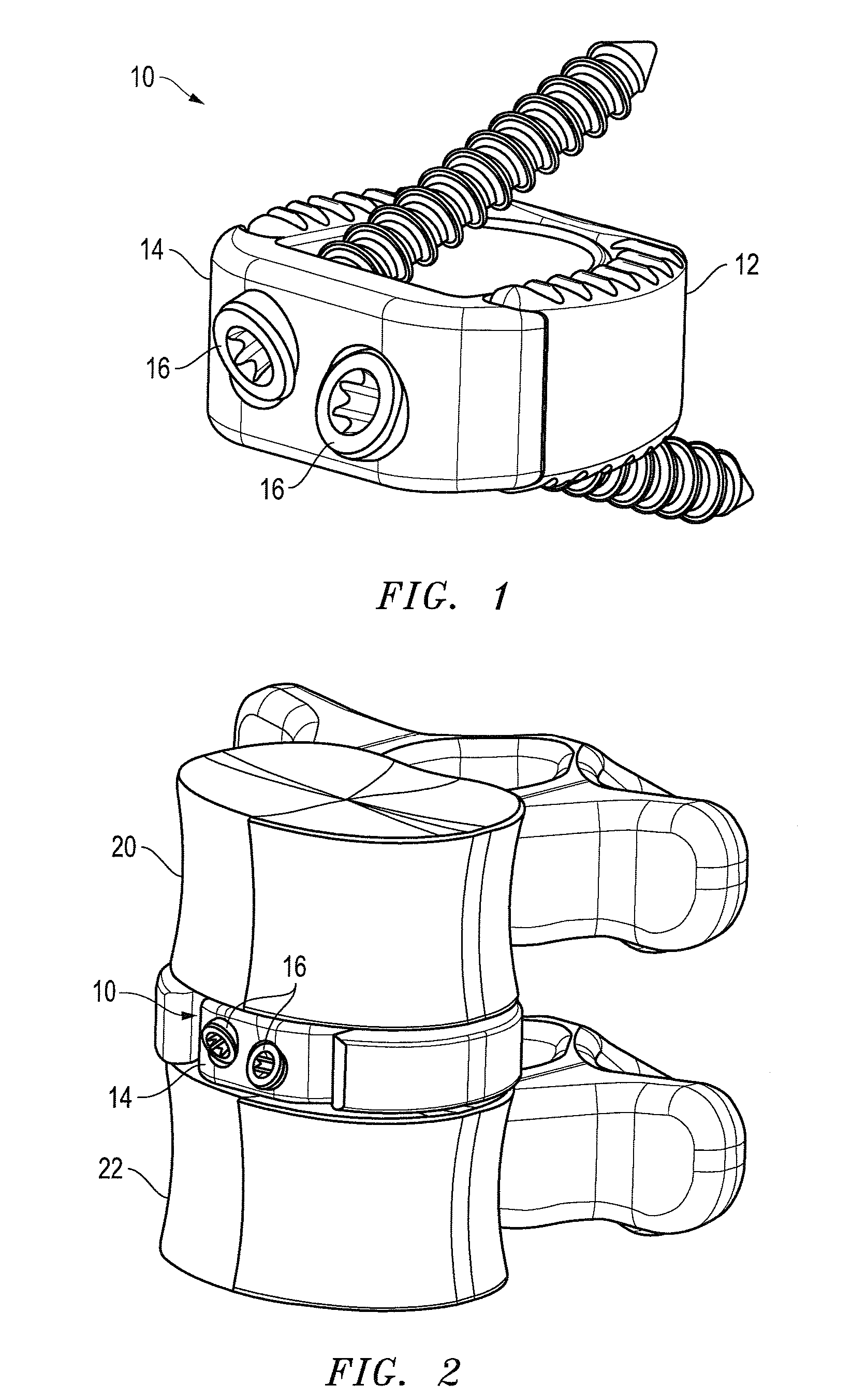 Interbody fusion device with snap on anterior plate and associated methods