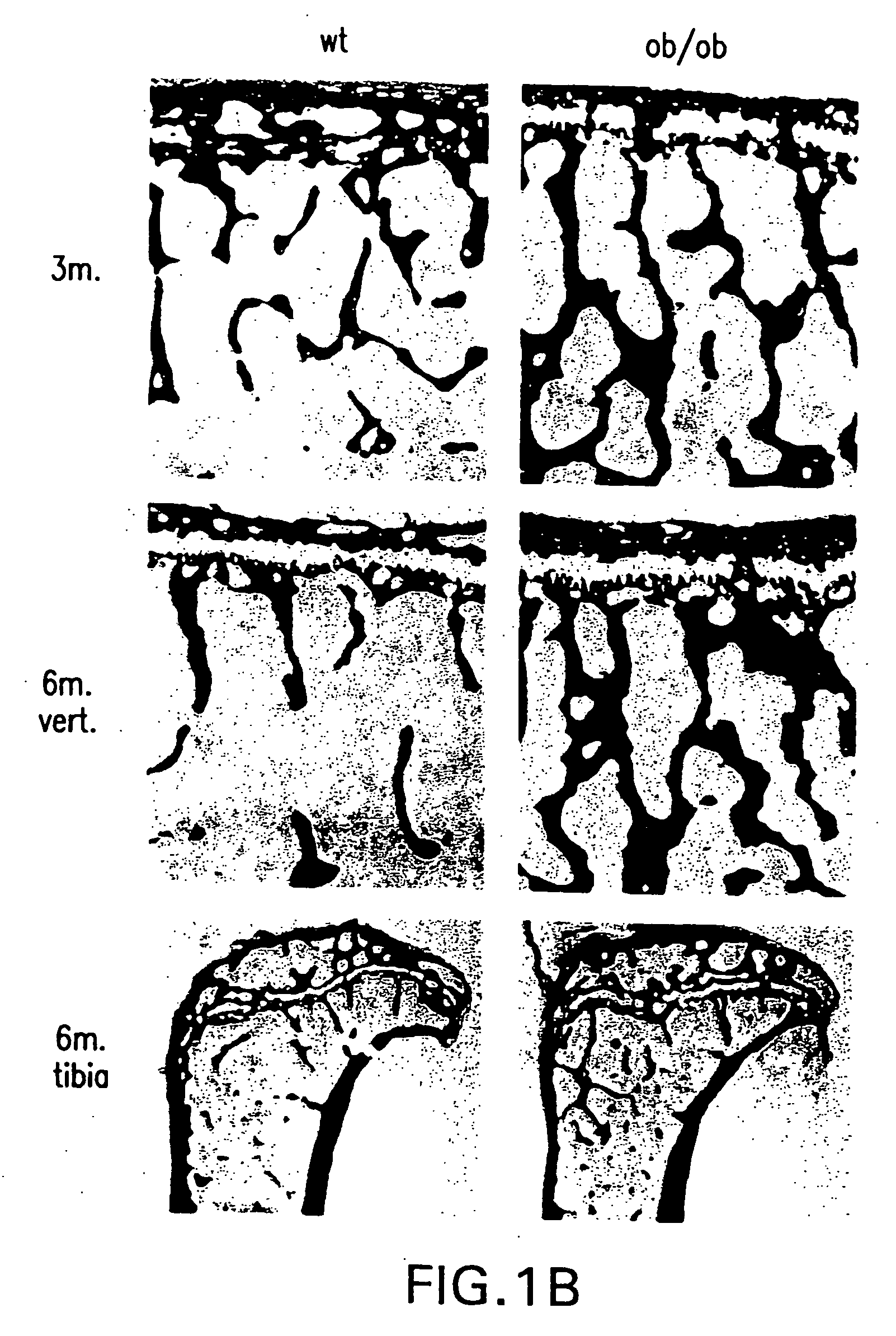 Methods and compositions for control of bone formation via modulation of sympathetic tone