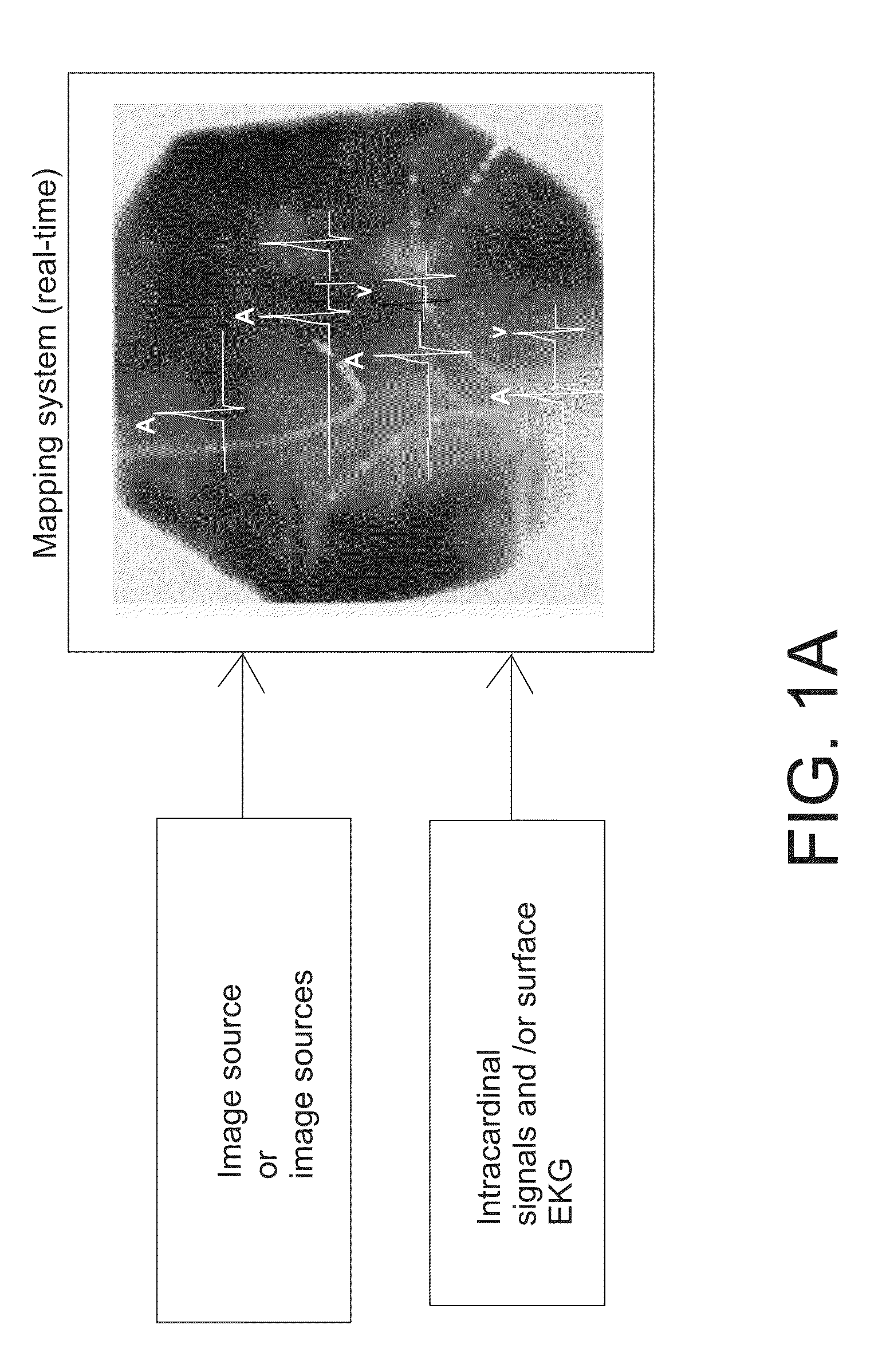 System and methods for real-time cardiac mapping
