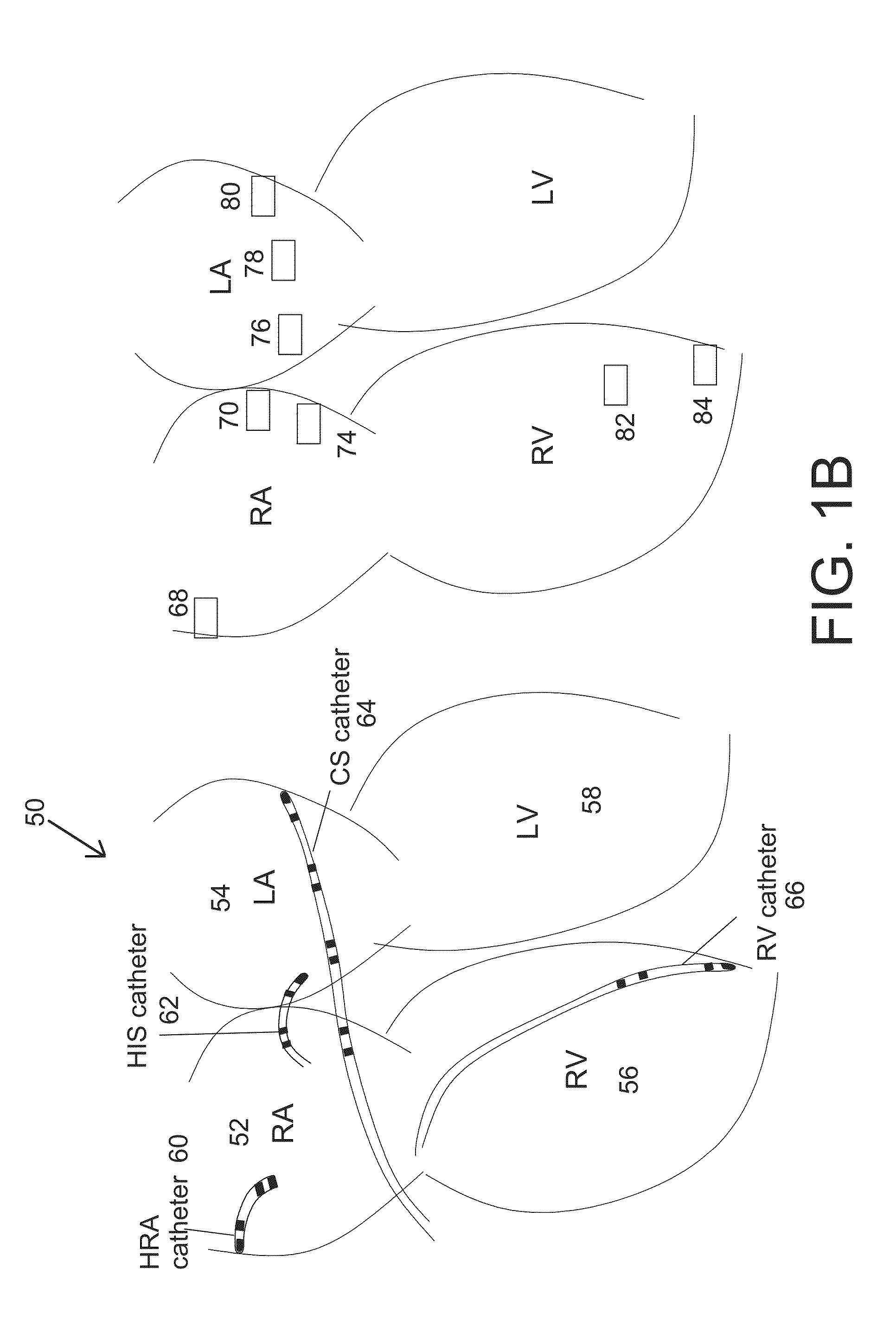 System and methods for real-time cardiac mapping