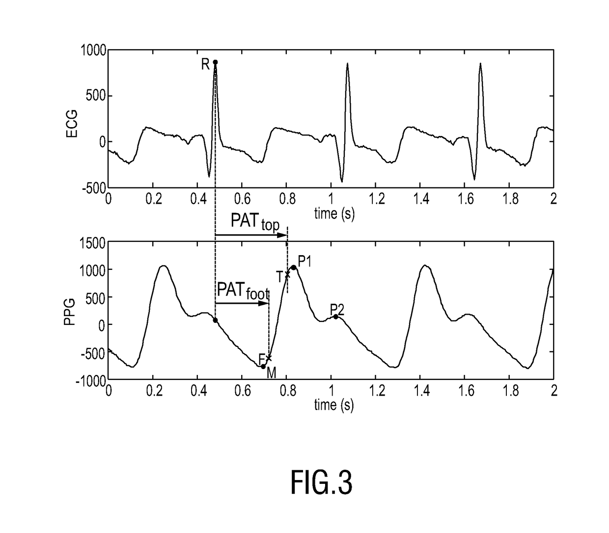 Device and method for obtaining pulse transit time and/or pulse wave velocity information of a subject