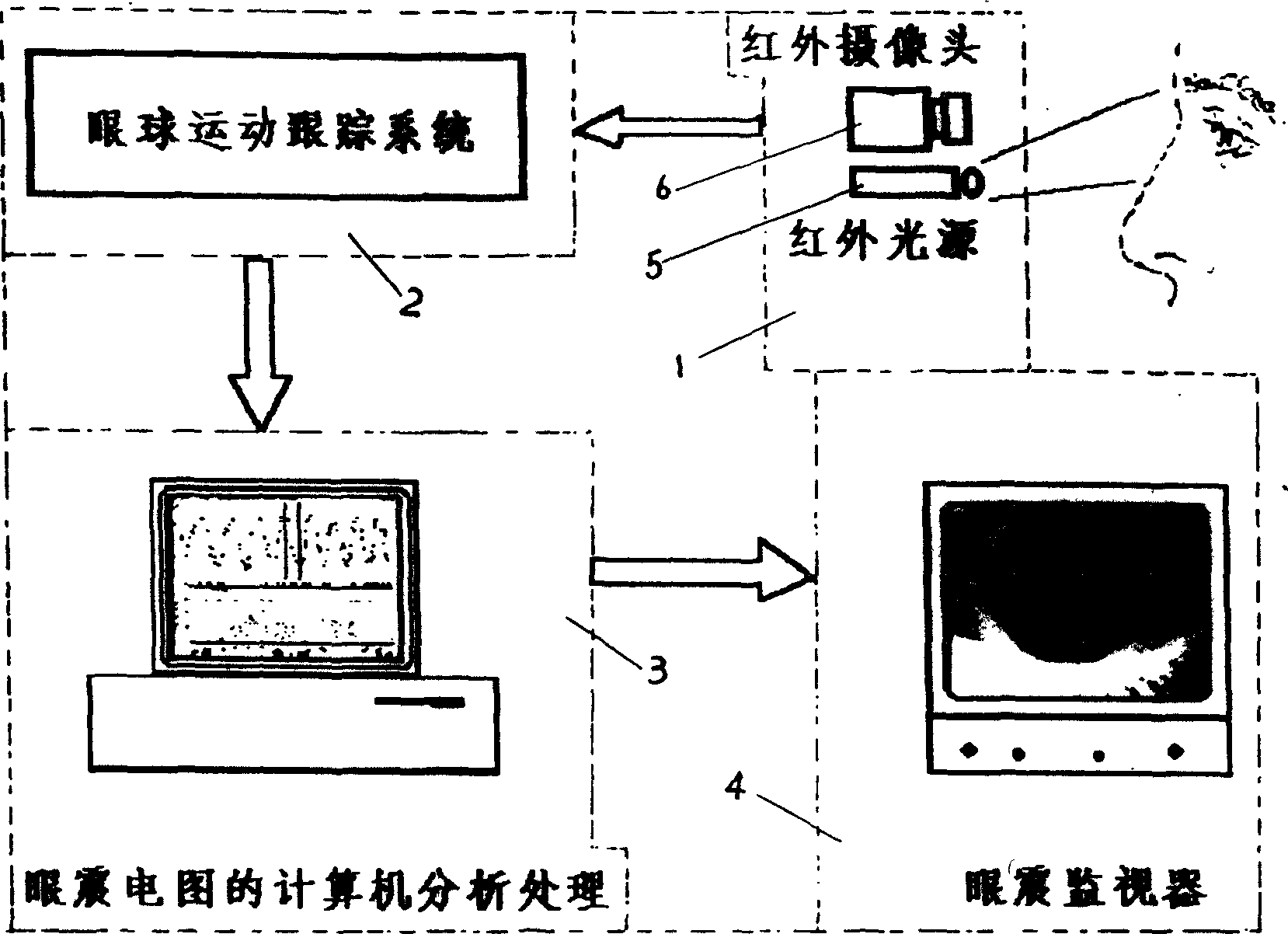 Video frequency electronystagmograph instrument and automatic generation of video frequency electronystagmograph