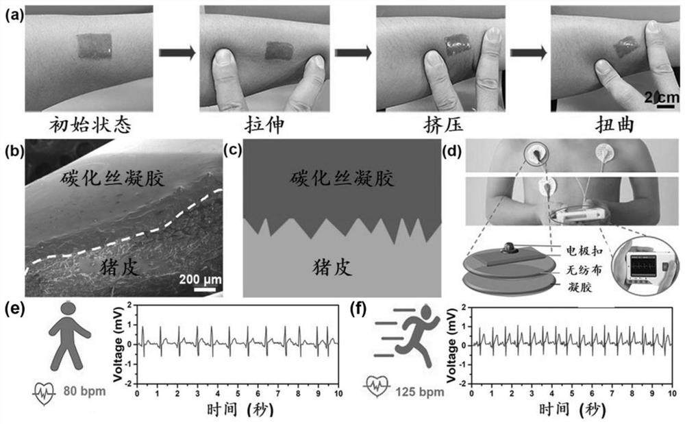 Full-silk-fibroin-based conductive gel sensor and preparation method thereof