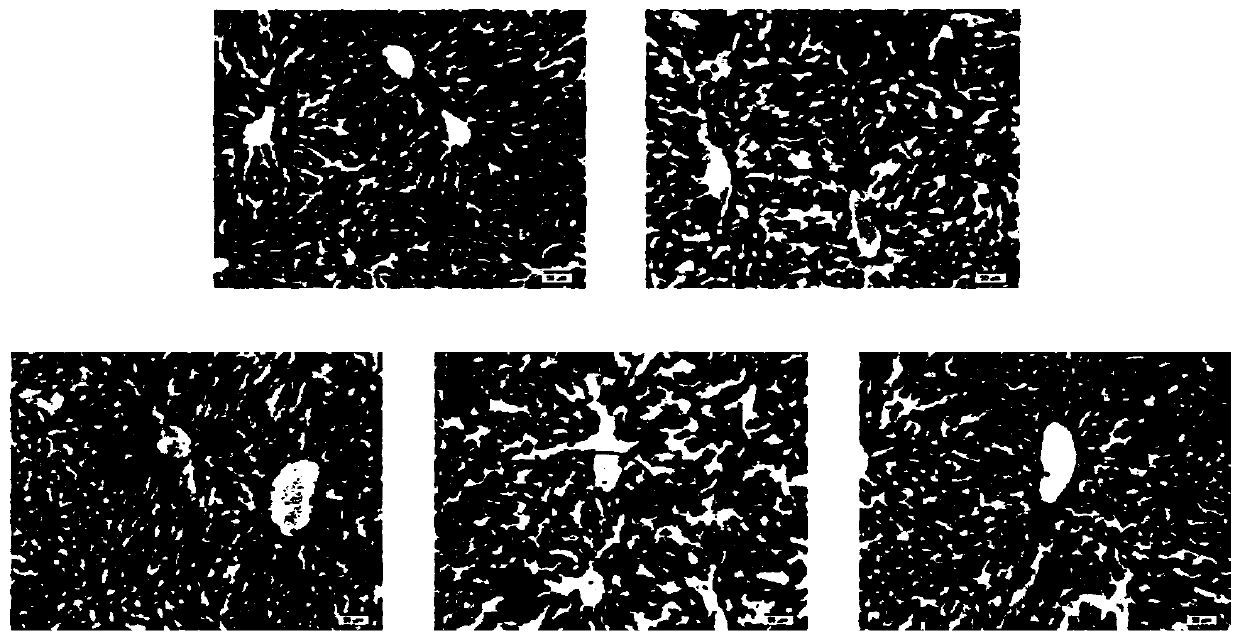 Application of crude broussonetia papyrifera leaf extract in preparation of drugs used for treating non-alcoholic fatty liver disease