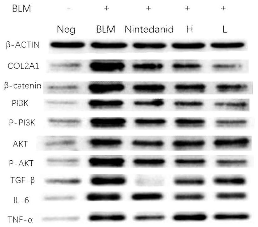 Application of high-sulfation fucogalactan from brown algae in drugs and health care products for preventing and treating pulmonary fibrosis