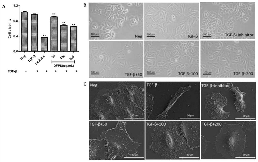 Application of high-sulfation fucogalactan from brown algae in drugs and health care products for preventing and treating pulmonary fibrosis